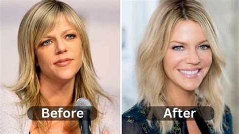 kaitlin olsen plastic surgery|Kaitlin Olson Plastic Surgery Photos [Before & After]